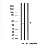 NEIL2 Antibody in Western Blot (WB)