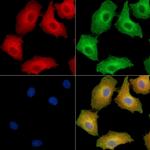 EDEM2 Polyclonal Antibody