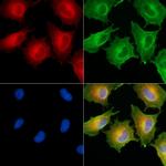 HSD17B12 Polyclonal Antibody