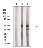 eIF5 Antibody in Western Blot (WB)