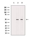 eIF5 Antibody in Western Blot (WB)
