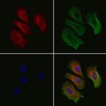 ETAA1 Polyclonal Antibody