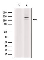 ETAA1 Antibody in Western Blot (WB)