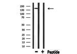 FANCM Antibody in Western Blot (WB)