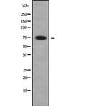 FIGNL1 Polyclonal Antibody