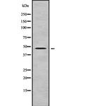 FOXD4L5 Antibody in Western Blot (WB)