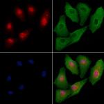 FNBP4 Antibody in Immunocytochemistry (ICC/IF)