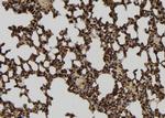 GPATCH8 Antibody in Immunohistochemistry (Paraffin) (IHC (P))