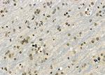 GPATCH8 Antibody in Immunohistochemistry (Paraffin) (IHC (P))