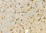 GPATCH8 Antibody in Immunohistochemistry (Paraffin) (IHC (P))