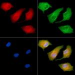 Connexin 31.1 Polyclonal Antibody