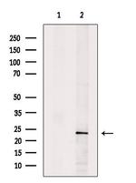 HPGDS Polyclonal Antibody