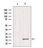 GPSM3 Polyclonal Antibody