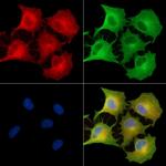 GIMA7 Polyclonal Antibody