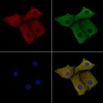 MTG2 Polyclonal Antibody