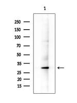 REM2 Antibody in Western Blot (WB)