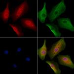 RABIF Polyclonal Antibody