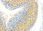 GUCA2B Polyclonal Antibody