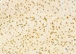 HEATR1 Antibody in Immunohistochemistry (Paraffin) (IHC (P))