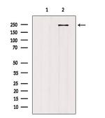 HEATR1 Antibody in Western Blot (WB)