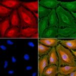 HLA-DMA Polyclonal Antibody