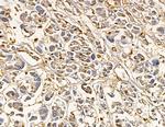 HLA-DMA Antibody in Immunohistochemistry (Paraffin) (IHC (P))