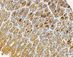 HLA-DMA Antibody in Immunohistochemistry (Paraffin) (IHC (P))