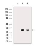 HLA-DMA Antibody in Western Blot (WB)