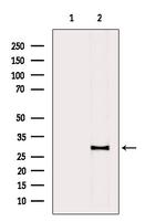 HLA-DMA Antibody in Western Blot (WB)