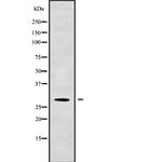 HLA-DMB Antibody in Western Blot (WB)