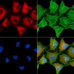 HLA-DQB2 Polyclonal Antibody