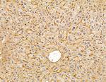 HLA-DQB2 Antibody in Immunohistochemistry (Paraffin) (IHC (P))