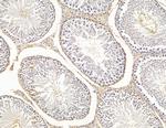 HLA-DQB2 Antibody in Immunohistochemistry (Paraffin) (IHC (P))