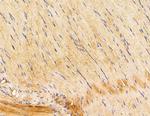 HLA-DQB2 Antibody in Immunohistochemistry (Paraffin) (IHC (P))