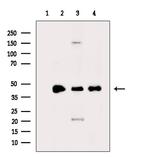 HOXD11 Polyclonal Antibody