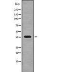 Nkx2.3 Polyclonal Antibody