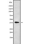 Nkx6.1 Polyclonal Antibody