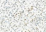 NKX6-2 Polyclonal Antibody