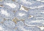 CD179a Antibody in Immunohistochemistry (Paraffin) (IHC (P))