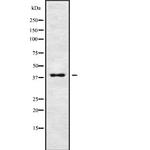 KIR2DL2 Antibody in Western Blot (WB)