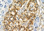 KIR2DL5A Antibody in Immunohistochemistry (Paraffin) (IHC (P))