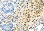 KIR2DL5A Antibody in Immunohistochemistry (Paraffin) (IHC (P))