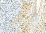 KIR2DL5A Antibody in Immunohistochemistry (Paraffin) (IHC (P))