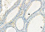 KIR2DL5A Antibody in Immunohistochemistry (Paraffin) (IHC (P))