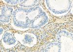 KIR2DL5A Antibody in Immunohistochemistry (Paraffin) (IHC (P))