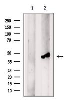 KIR2DL5A Antibody in Western Blot (WB)