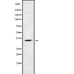 KIR2DS5 Antibody in Western Blot (WB)