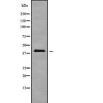 A4GALT Polyclonal Antibody