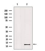 MED11 Antibody in Western Blot (WB)