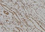 MED22 Polyclonal Antibody